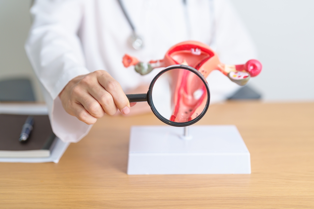 Doctor with Uterus and Ovaries anatomy model and magnifying glass. Ovarian and Cervical cancer, Cervix disorder, Endometriosis, Hysterectomy, Uterine fibroids, Reproductive system, Pregnancy