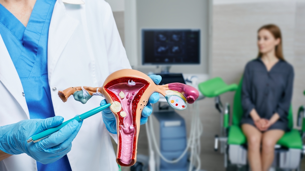 Uterine fibroid, myoma. Gynecologist pointing uterine leiomyomas on anatomical model of uterus while female patient's gynecological consultation