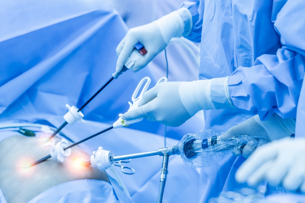 Team of doctor did laparoscopic cholecystectomy inside operating room in hospital