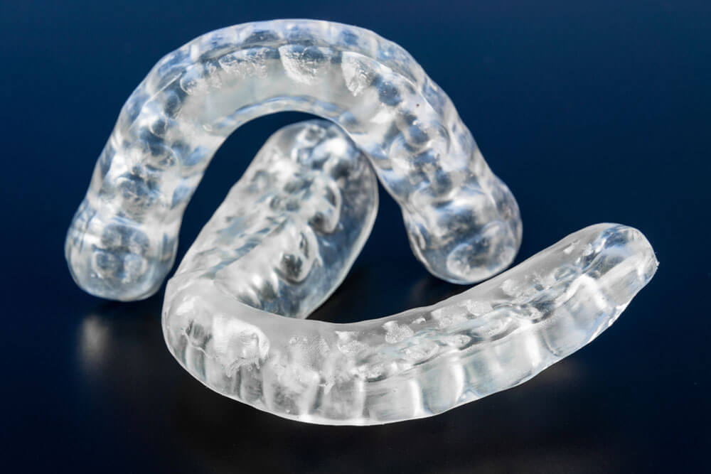 Dental splint to prevent bruxism