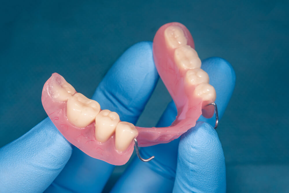 Close-up human denture of the upper jaw