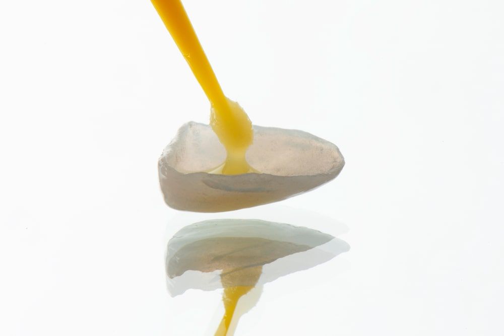 Bonding procedure of preparing porcelain laminated veneer before installation in patient mouth