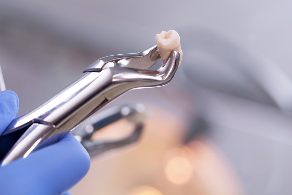 Dental equipment holding an extracted tooth