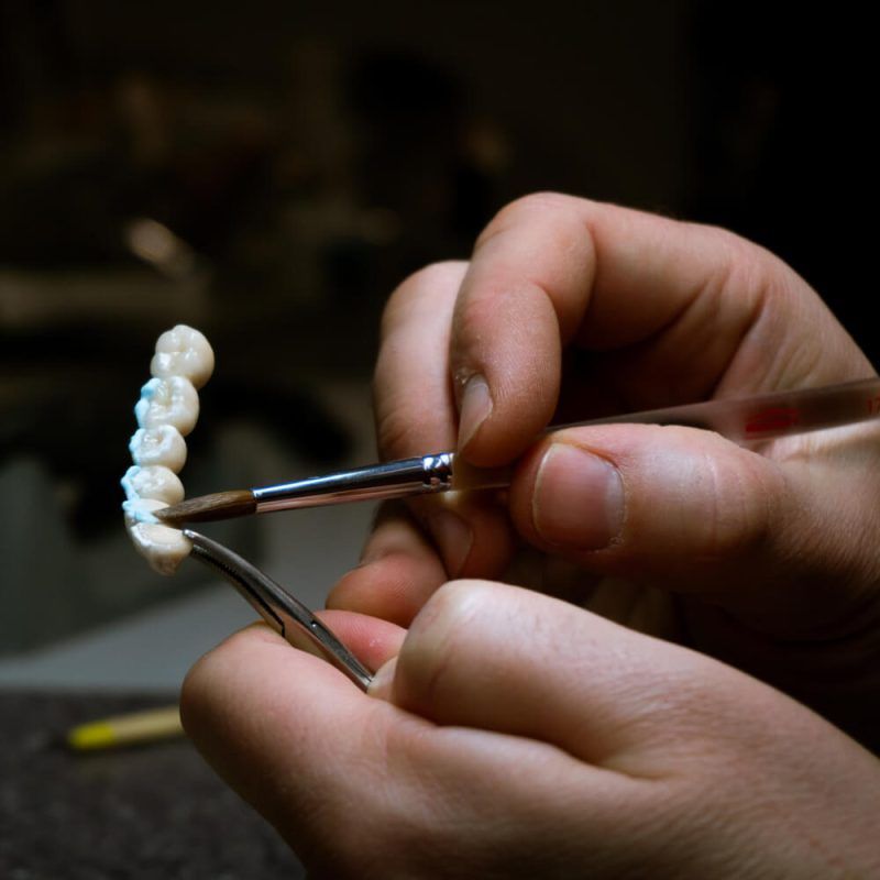 dental technician will design dental crowns. close-up. laboratory.