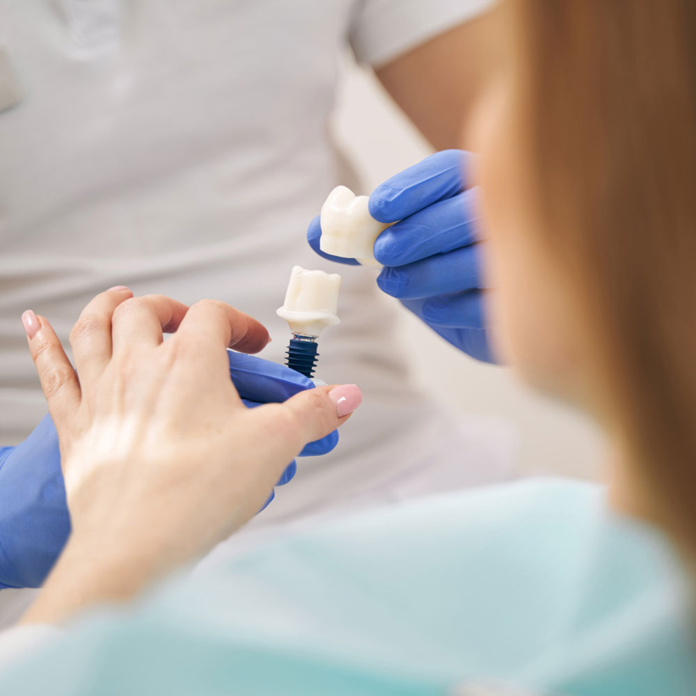 Dentist showing dental implant to woman in clinic