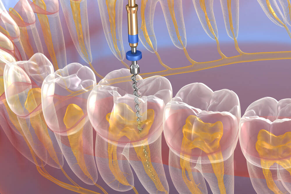 Medically accurate tooth 3D illustration.