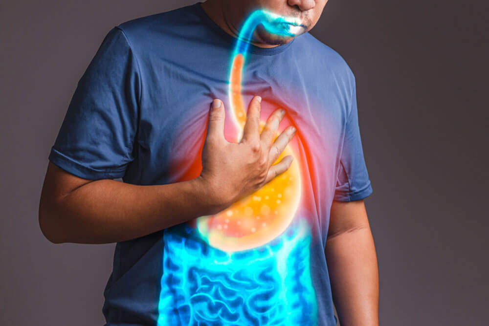 gastroesophageal reflux disease : GERD