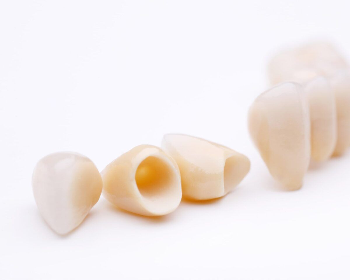 Macro of prosthetic teeth