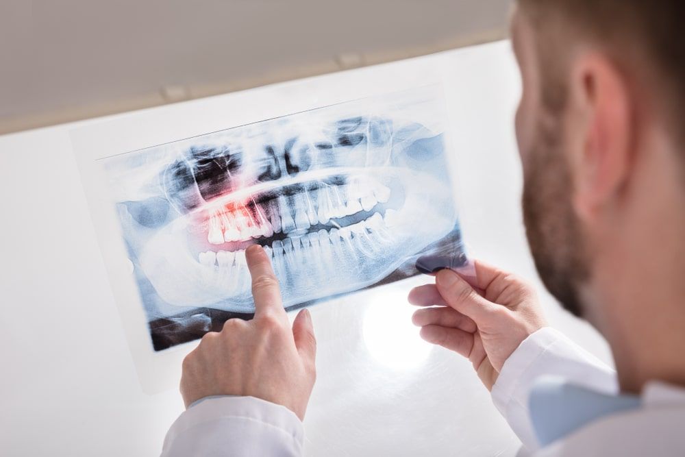 A Doctor's Hand Holding Teeth X-ray