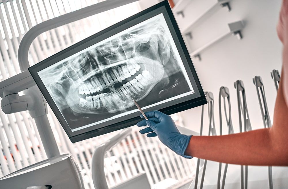 dentist presenting with tooth x-ray film to patient in the treatment room