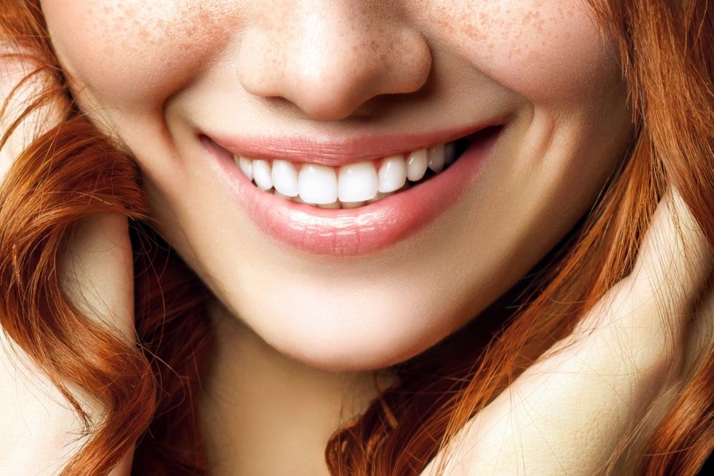 Beautiful female smile after teeth whitening procedure