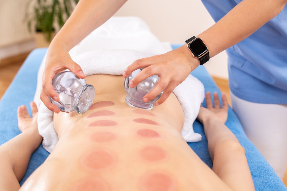 Woman Getting Cupping Treatment At a Spa