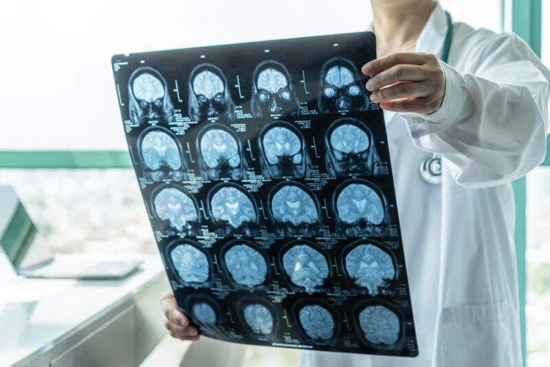 Concussion-and-Post-Concussion-Symptoms_1537198925