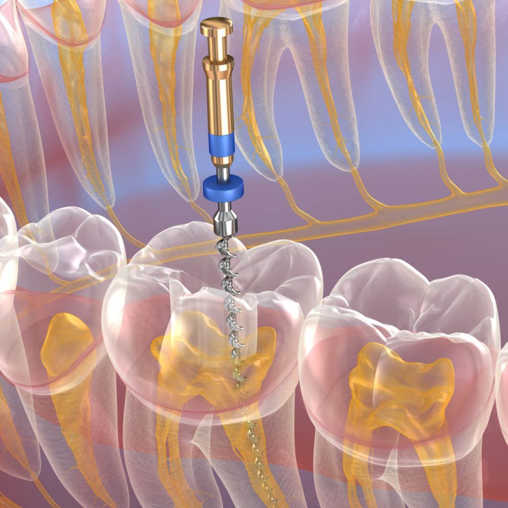 Medically accurate tooth 3D illustration.