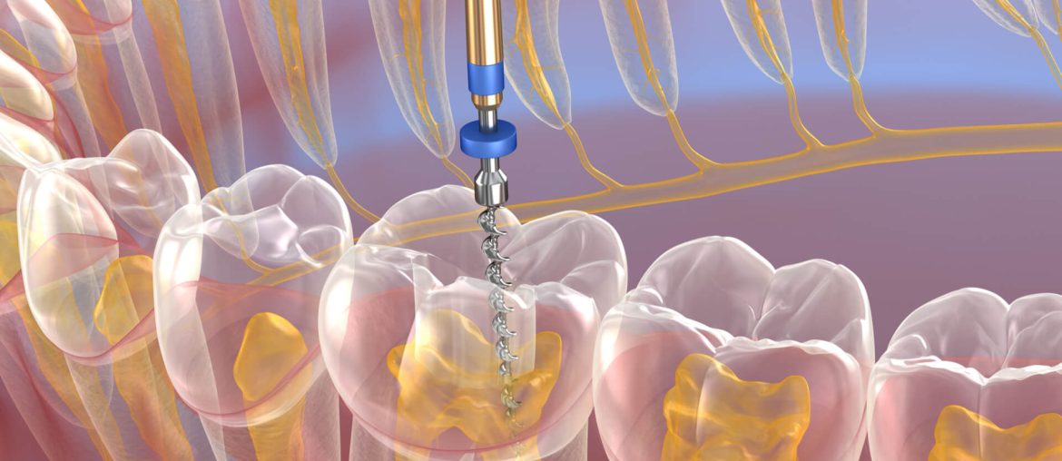 Medically accurate tooth 3D illustration.