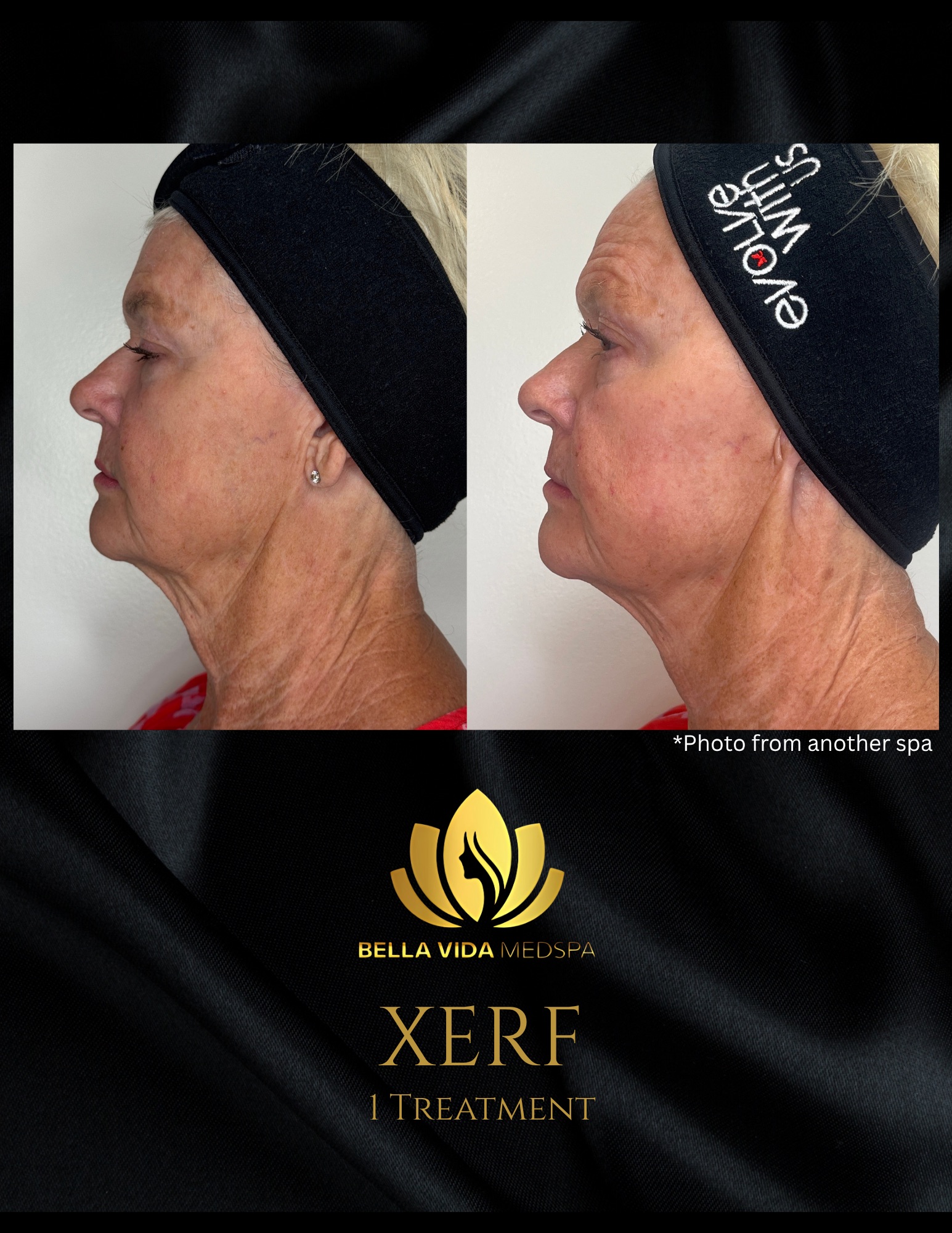 Before and Afters (Bound Documents) - 6