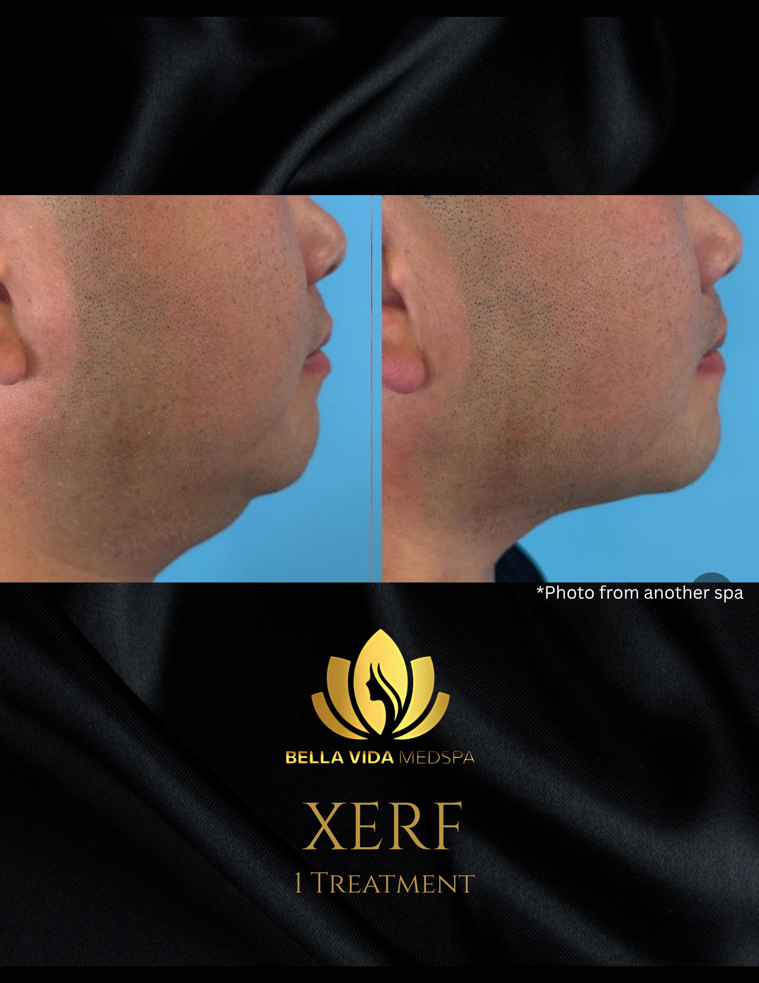 Before and Afters (Bound Documents) - 10