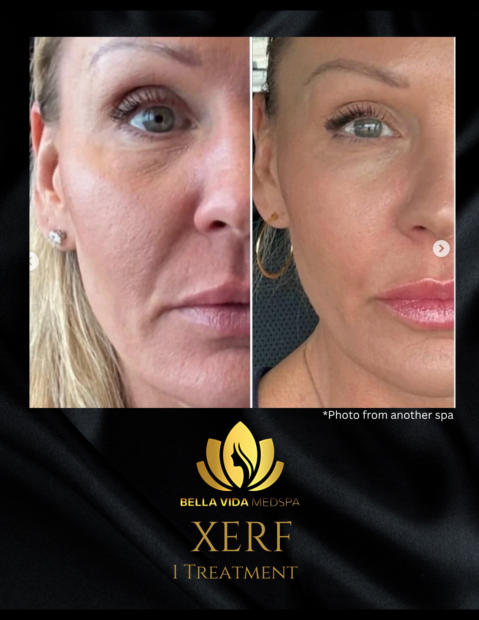 Before and Afters (Bound Documents) - 15