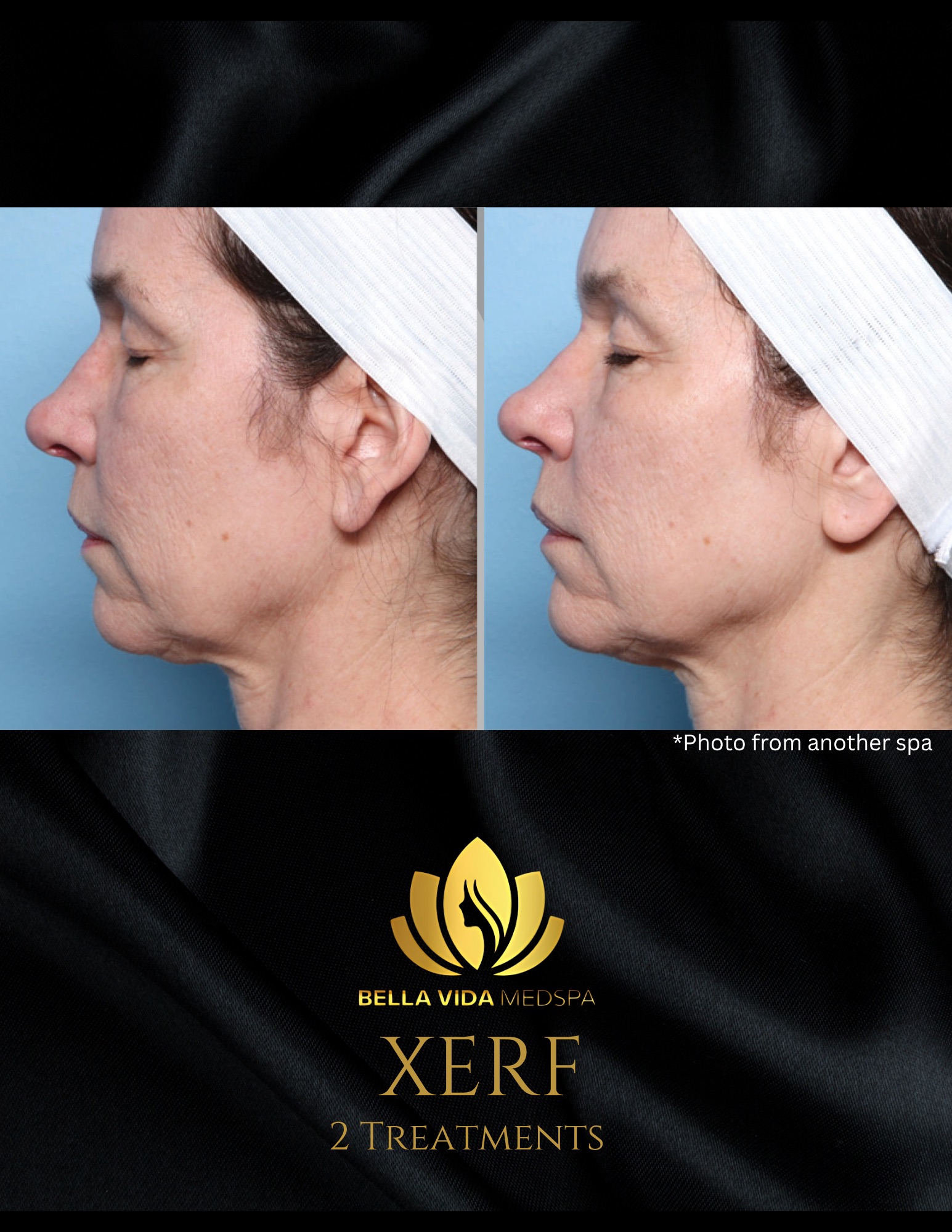 Before and Afters (Bound Documents) - 14