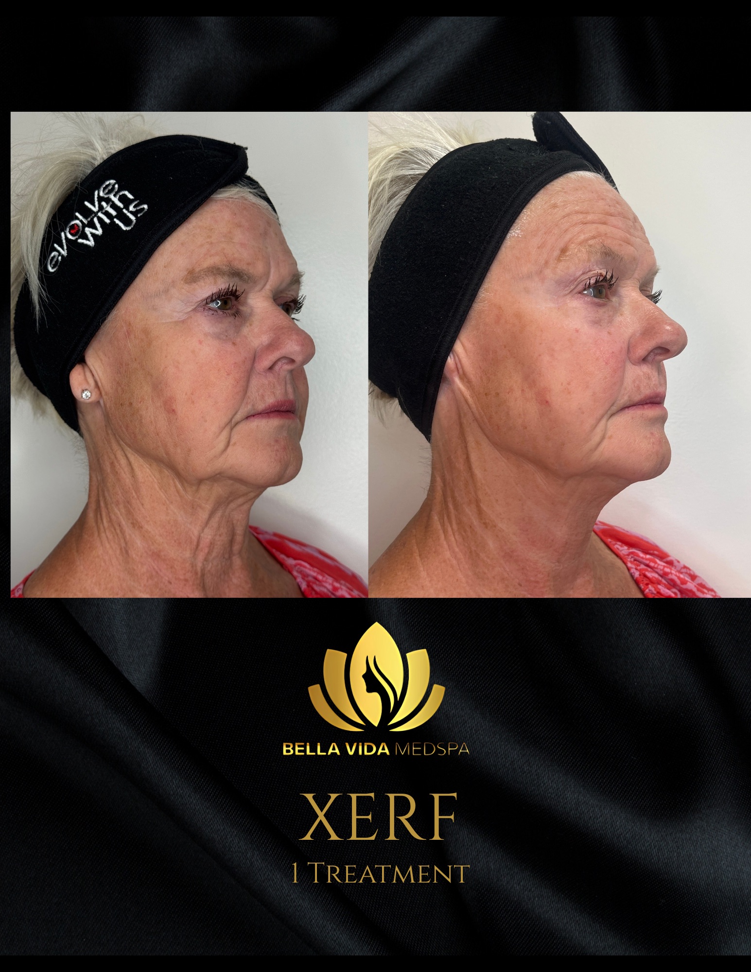 Before and Afters (Bound Documents) - 4