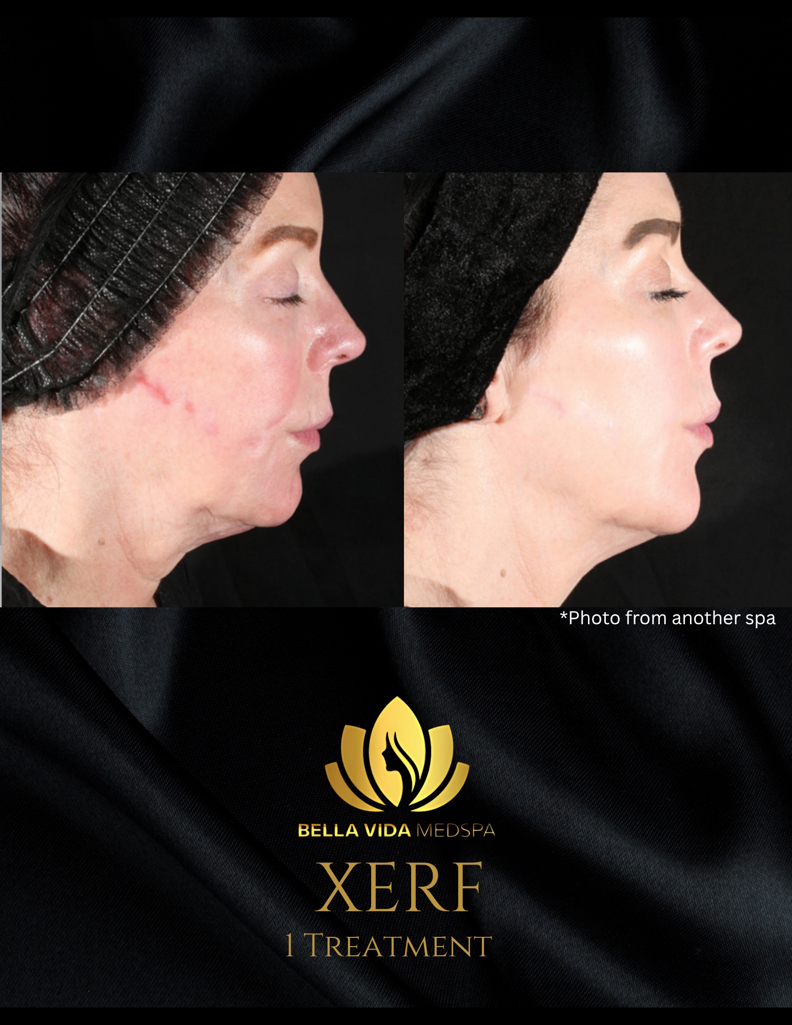 Before and Afters (Bound Documents) - 13