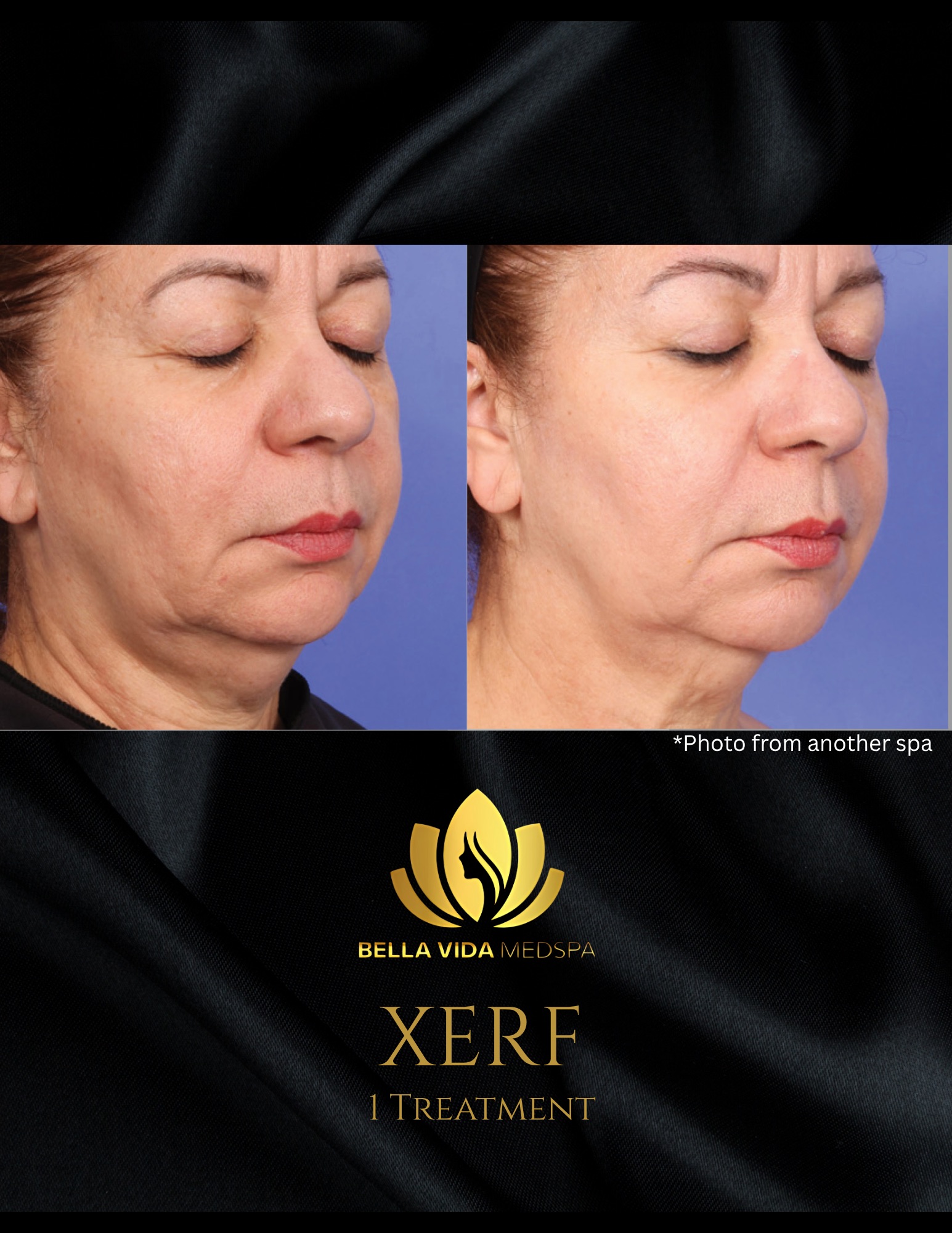 Before and Afters (Bound Documents) - 11