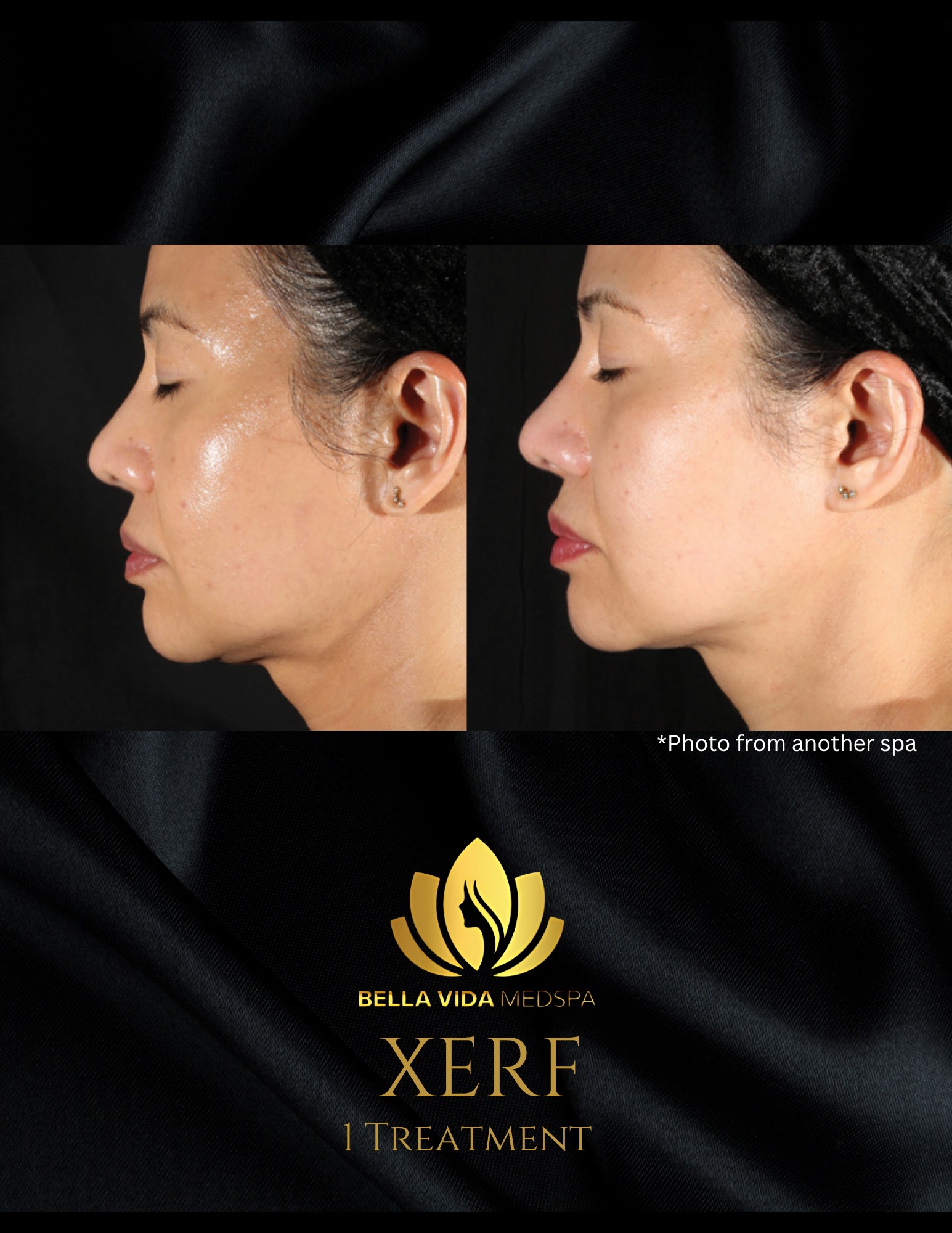 Before and Afters (Bound Documents) - 12