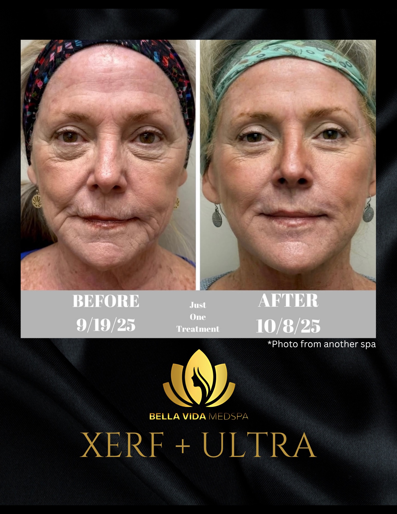 Before and Afters (Bound Documents) - 7