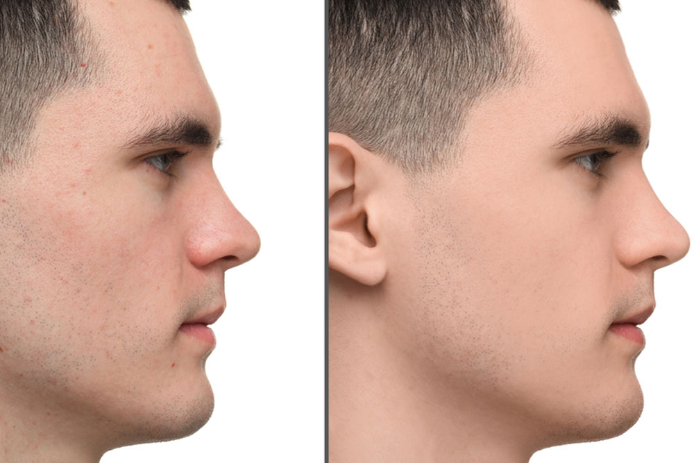 shutterstock_2665755719