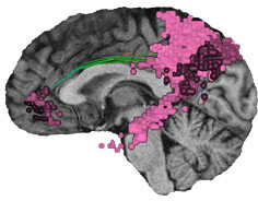 Default mode network