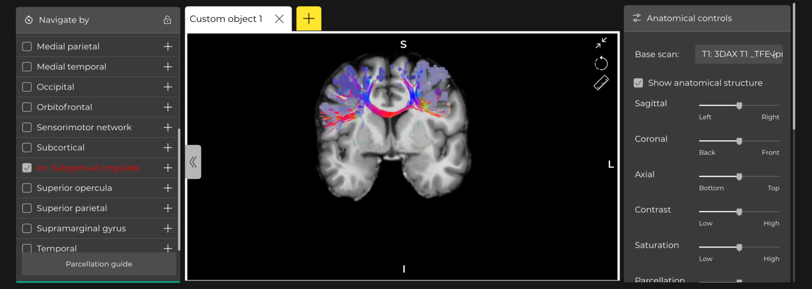 Brain 2D image on screen