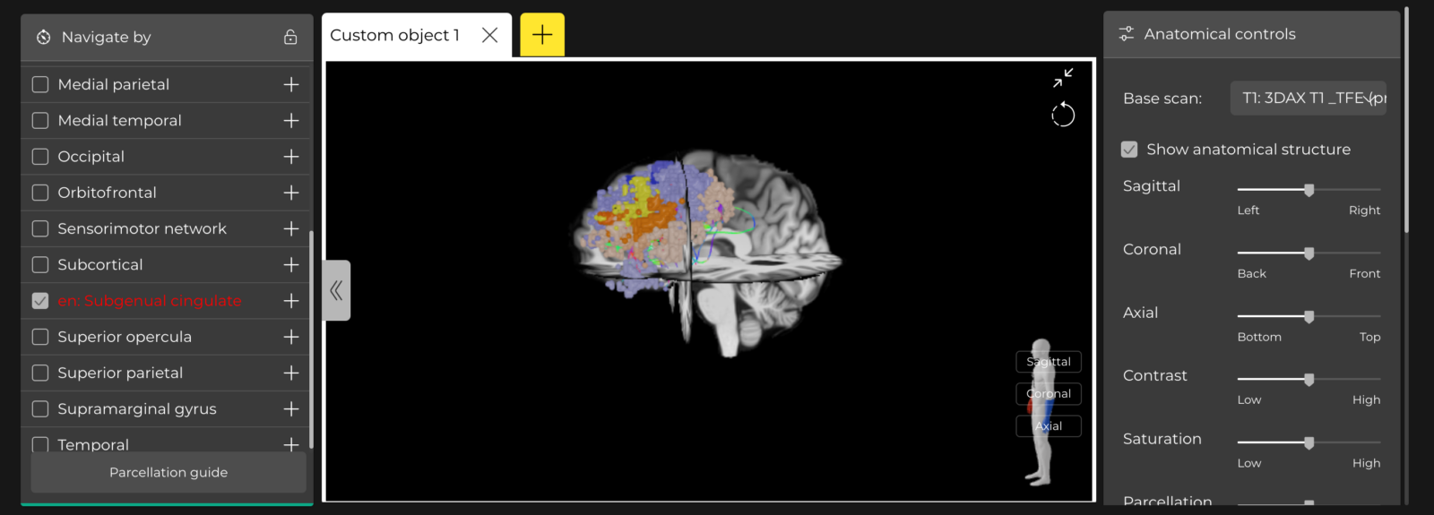 Brain 2D image on screen
