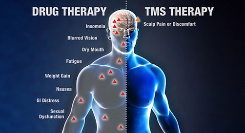 Difference between drug therapy and TMS therapy