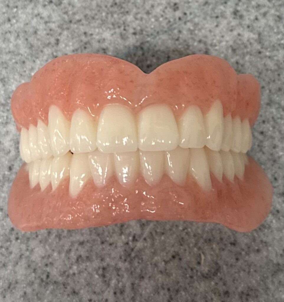 Ivoclar Milled Denture