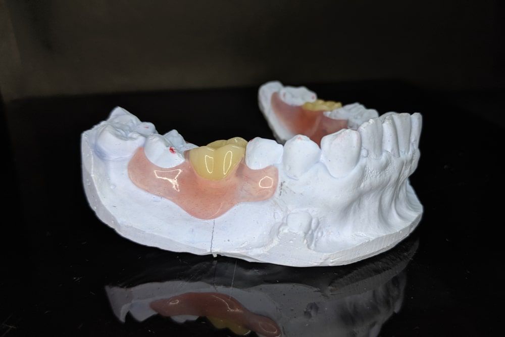 Partial denture made from thermosens material
