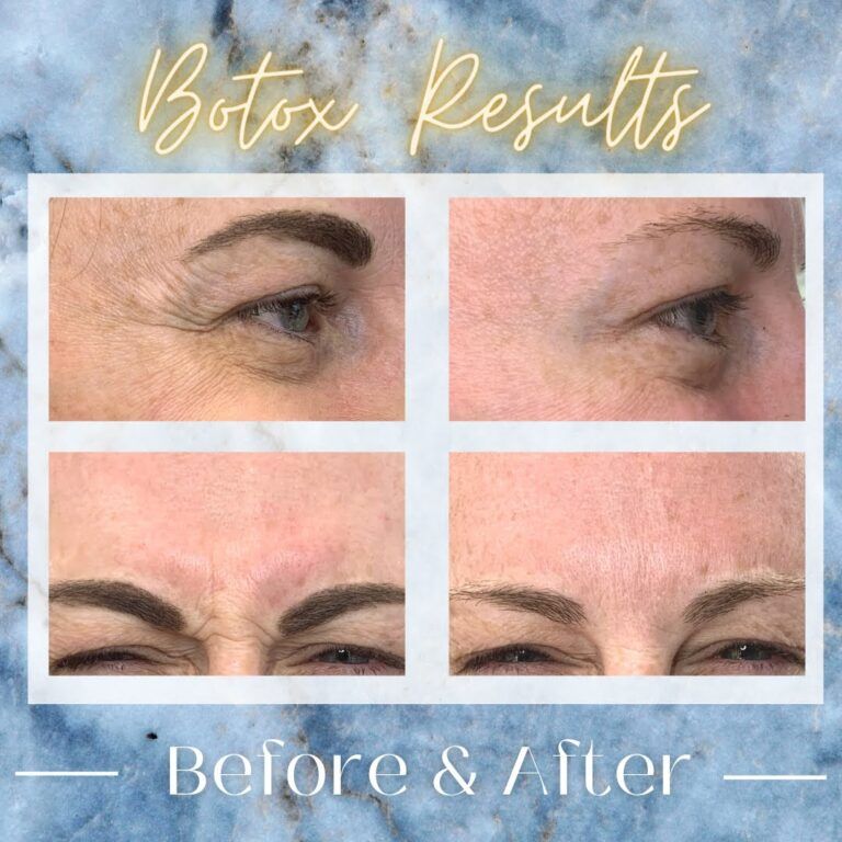 Before & After Gallery Oro Valley Aesthetics Oro Valley, AZ