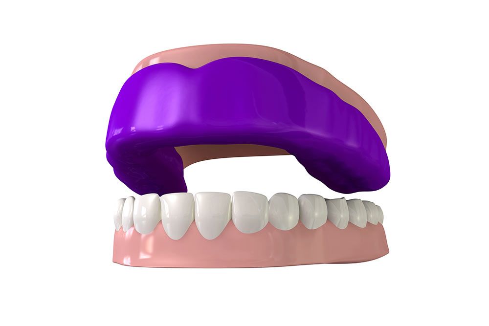 Mouthguard on Dental model