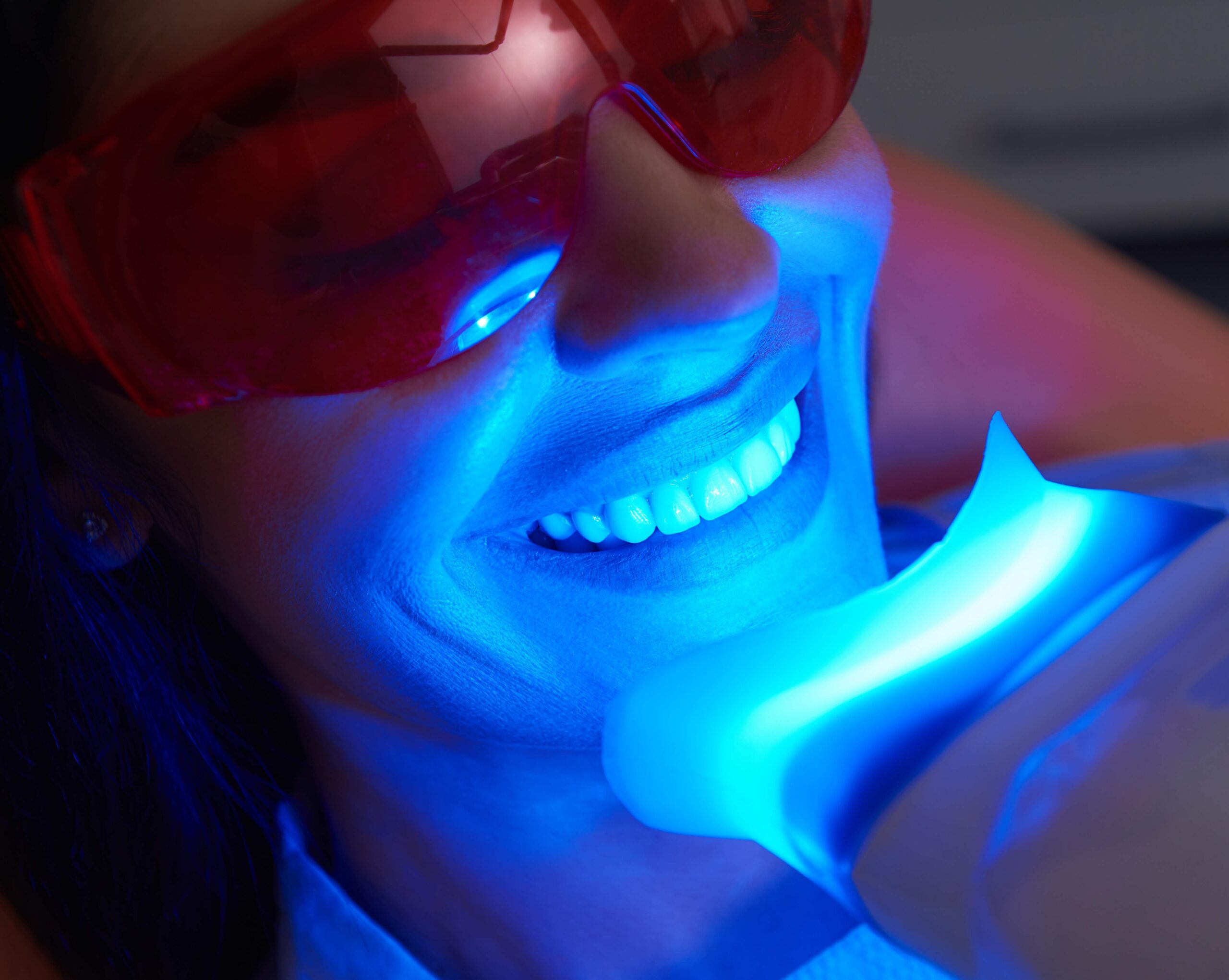 Professional Teeth Whitening in Winter Haven, FL
