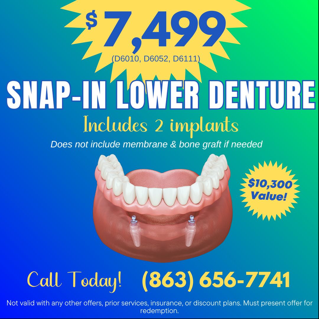 $7499 Snap in Lower Denture Special Offer