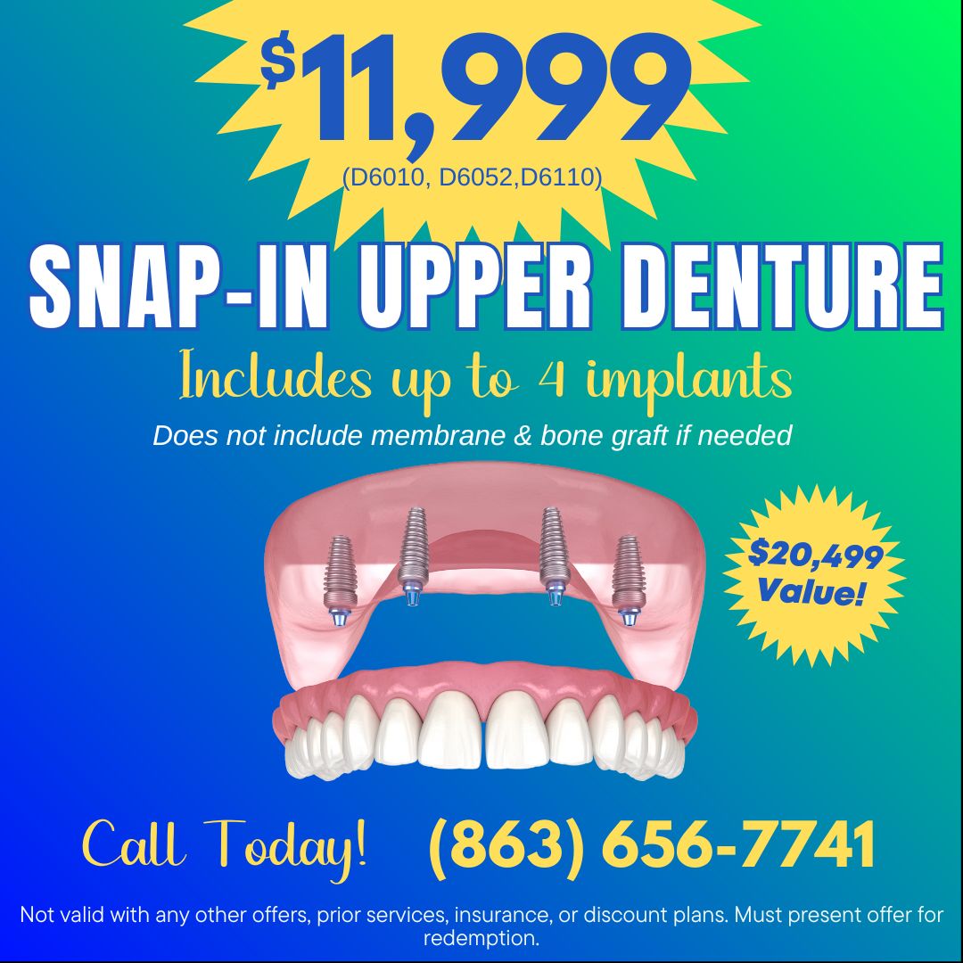 $11999 Snap In Upper Denture Special Offer
