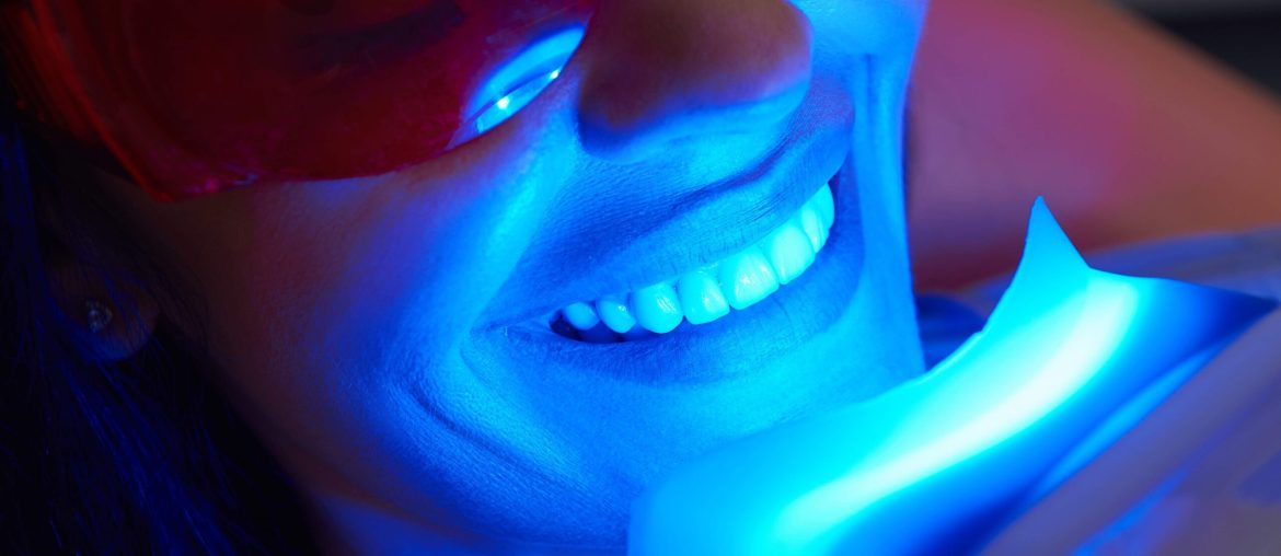 Professional Teeth Whitening in Winter Haven, FL