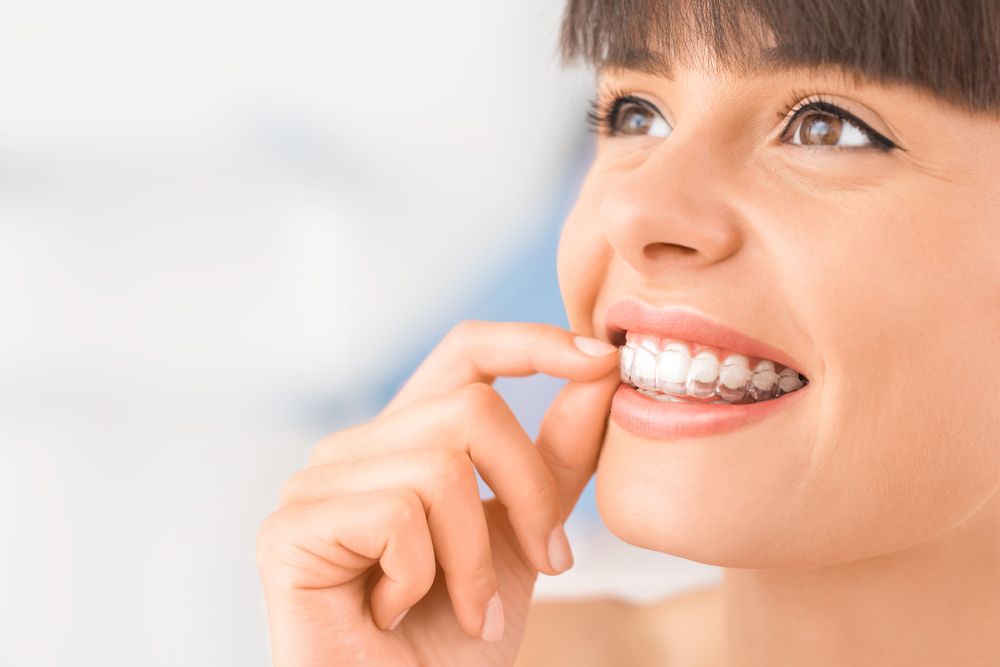 A young woman removing her dental trays for Invisalign® Treatment for Teens