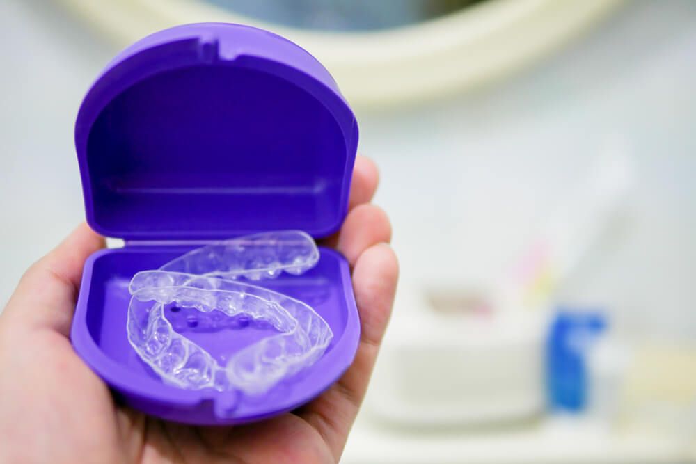Clear plastic retainer teeth