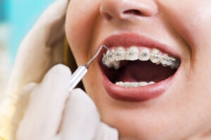 Young woman checking her braces