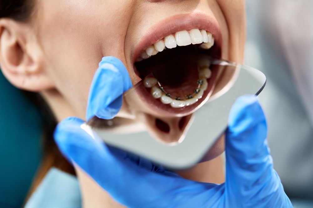 An orthodontist checking lingual braces on their patient