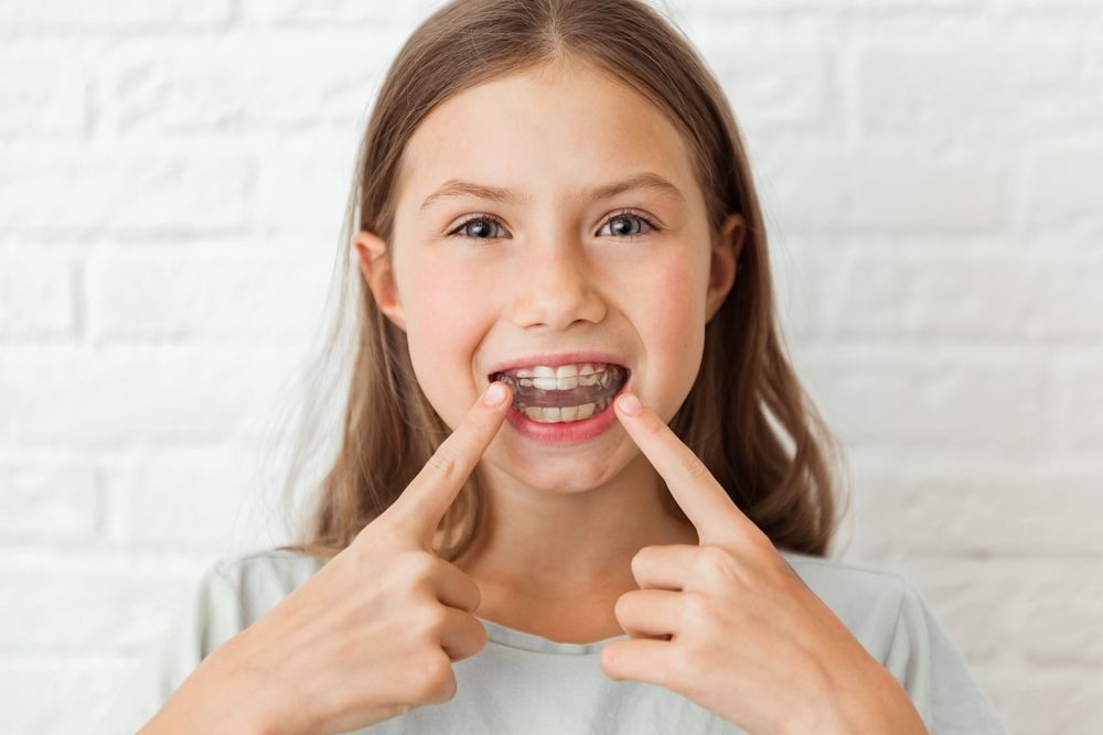 Everything You Need to Know About Lingual Braces - Davis Orthodontics