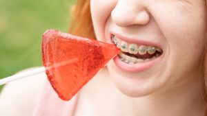 Beautiful young woman with braces on her teeth eats a watermelon-shaped lollipop outdoors.