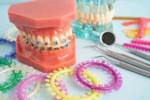 Orthodontic ligatures rings and ties, elastic rubber bands on orthodontic braces, model for dentist studying about dentistry.