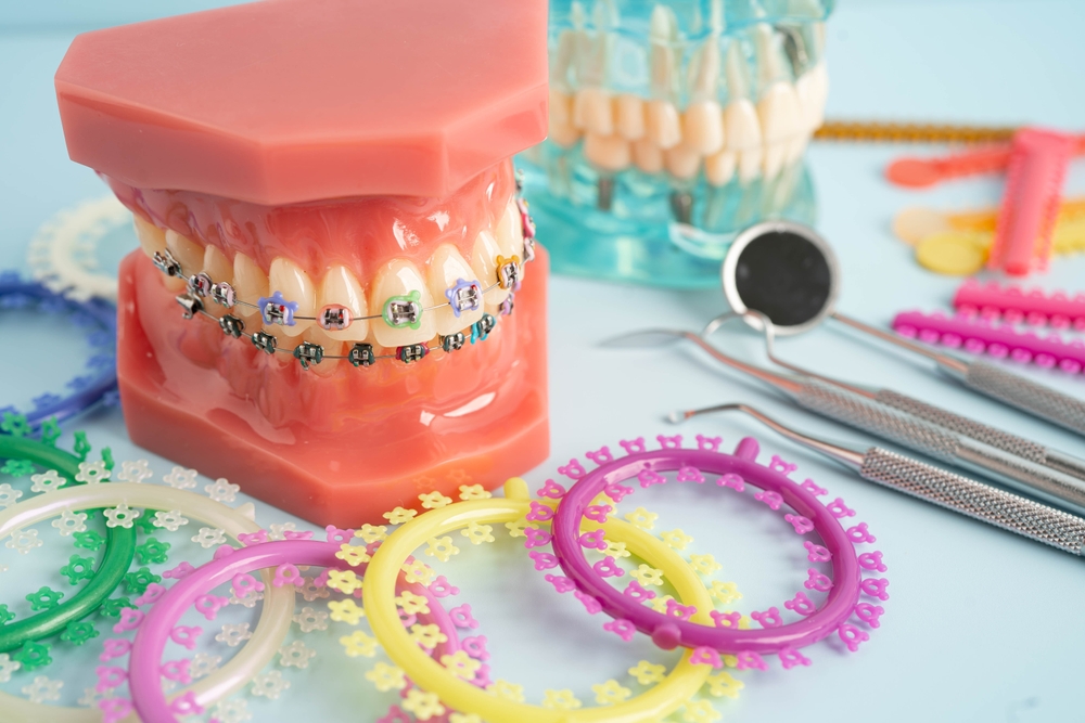 Orthodontic ligatures rings and ties, elastic rubber bands on orthodontic braces, model for dentist studying about dentistry.