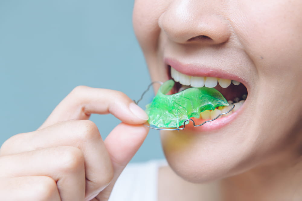 Asian woman wearing orthodontic retainers. Teeth retaining tools after braces .